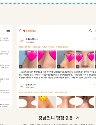 강남언니 에디션성형외과 후기