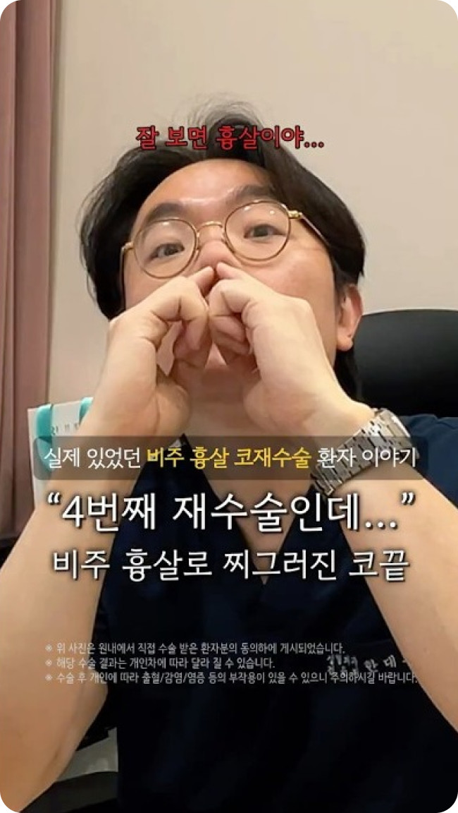 비주 흡살 코재수술