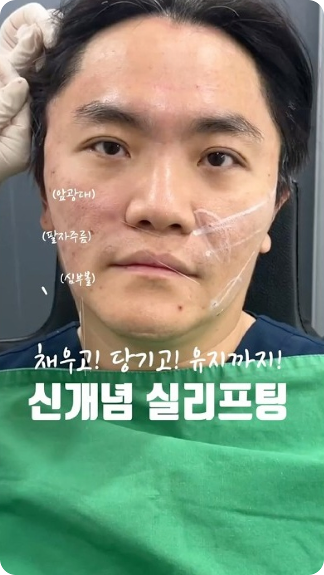 신개념 실리프팅